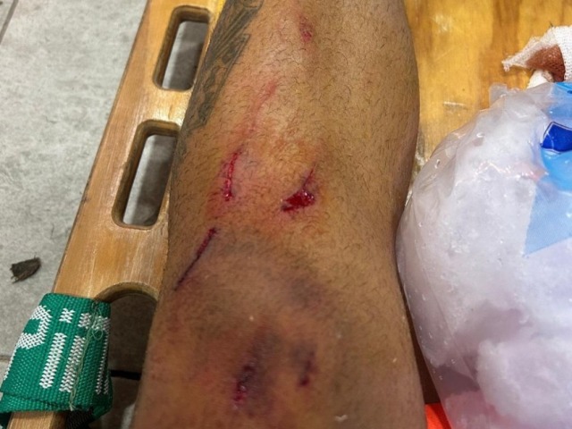 Nueve partidos de suspensi�n para un jugador de Loma Negra